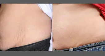 ba-icon-1540-s-doherty-3tx-crop-u814