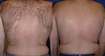 icon-k-khatri-back-hair-post3tx-crop-u882